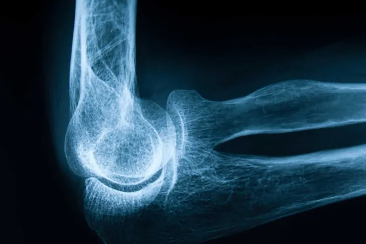 Test Your Knowledge: How Familiar Are You with Bones?